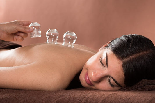 Exploring Traditional Chinese Fire Cupping: A Unique Path to Wellness. A young lady laying face down on a massage table and glass cups being placed on her back